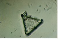 Triceratium reticulum - 46.4 microns per side