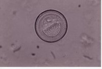 Cyclotella species, probably stylorum - 39.3 microns - There is one half of the interior portion well in focus, the other half focuses at a different plane, showing it has a wave like profile as well as being round and petri dish like.