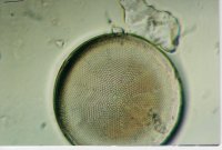 This Coscinodiscus species is only 71.4 microns in diameter, yet clearly shows how wonderfully complex they are. Petri dish style connection with hundreds of individual depressions to gain what it needs from the outside. And with all that complexity, it is pizza pie in divisions also.