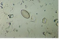 A Coccneis species on a texture field of broken and partial diatoms.